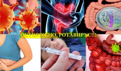 Ротавирусная инфекция